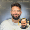 Sean 0.08 mm Thin Skin Toupee