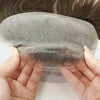 Receding Hairlines FRONTAL