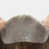 Receding Hairlines FRONTAL