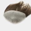 Receding Hairlines FRONTAL