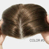 Receding Hairlines FRONTAL