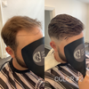 Thin V-Loop With Poly Thin Skin System